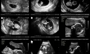 Ile czekać na wyniki badań prenatalnych? Wszystko, co musisz wiedzieć.