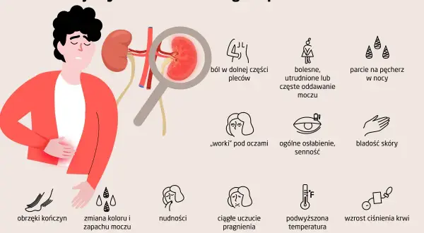 Ilustracja przedstawia objawy zakażenia nerek: ból pleców, problemy z oddawaniem moczu, obrzęki, nudności, gorączkę i inne.