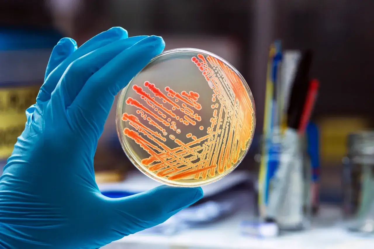 Lekarz pobierający wymaz do badania mikrobiologicznego