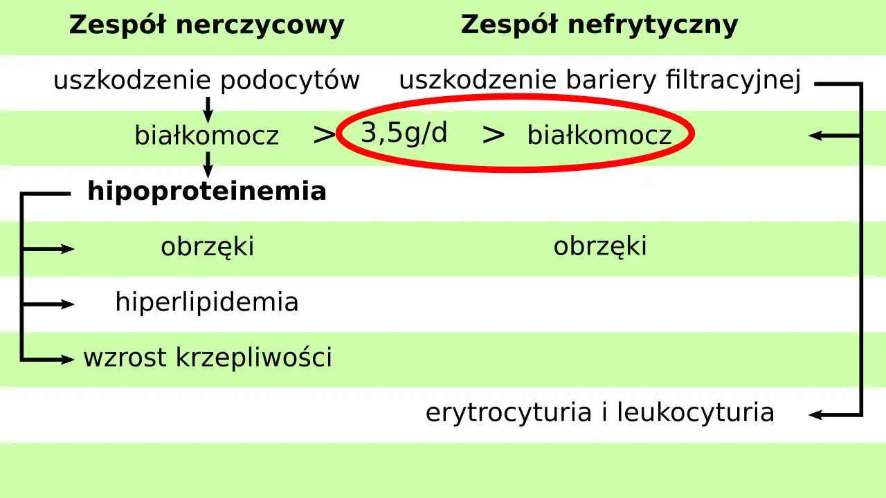 Schemat porównuje zespół nerczycowy i nefrytyczny u dzieci. Kluczowe objawy to białkomocz, hipoproteinemia, obrzęki, hiperlipidemia i wzrost krzepliwości.
