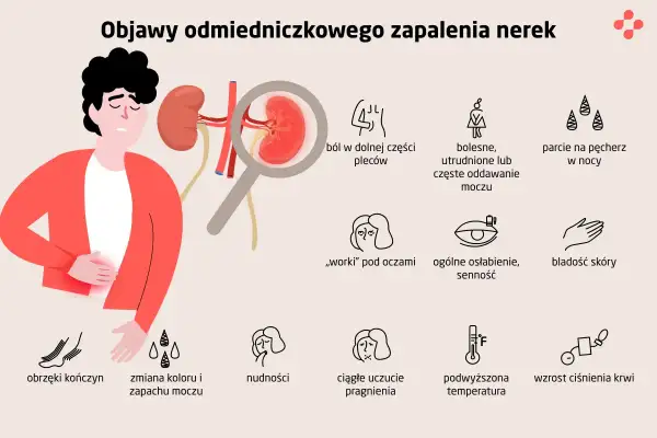Ilustracja przedstawia objawy zakażenia nerek: ból pleców, problemy z oddawaniem moczu, obrzęki, nudności, gorączkę i inne.